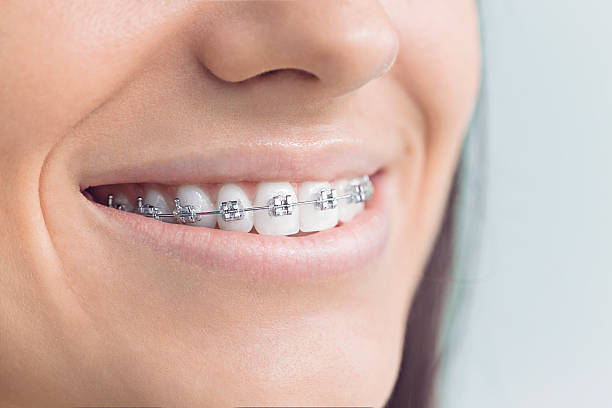 Best Dental Fillings (Composite and Amalgam)  in Farr West, UT